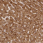 Immunohistochemical staining of human liver shows moderate to strong granular cytoplasmic positivity in hepatocytes.