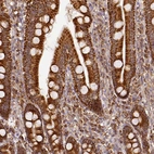 Immunohistochemical staining of human duodenum shows moderate to strong granular cytoplasmic positivity in glandular cells.