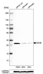 Western blot analysis in RT-4 cells transfected with control siRNA, target specific siRNA probe #1 and #2, using Anti-SDHB antibody. Remaining relative intensity is presented. Loading control: Anti-PPIB.