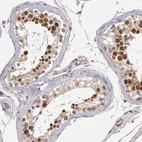 Anti-ABHD12B Antibody