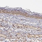 Immunohistochemical staining of human skin shows moderate nuclear positivity in squamous epithelial cells.