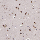 Anti-ABHD12B Antibody