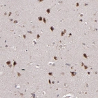Immunohistochemical staining of human cerebral cortex shows strong nuclear positivity in neurons.