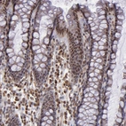 Immunohistochemical staining of human rectum shows moderate nuclear positivity in glandular cells.