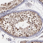 Immunohistochemical staining of human testis shows strong cytoplasmic positivity in cells in seminiferous ducts.
