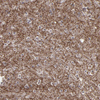 Immunohistochemical staining of human cerebral cortex shows strong cytoplasmic positivity in synapses.