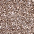 Anti-SIPA1L1 Antibody