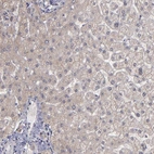 Immunohistochemical staining of human liver shows very weak cytoplasmic positivity in hepatocytes.