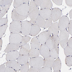Immunohistochemical staining of human skeletal muscle shows no cytoplasmic positivity in myocytes as expected.