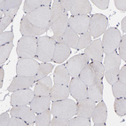 Anti-SIPA1L1 Antibody