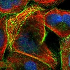Immunofluorescent staining of human cell line A-431 shows localization to plasma membrane & actin filaments.