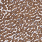 Immunohistochemical staining of human liver shows strong cytoplasmic positivity in hepatocytes.