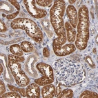 Immunohistochemical staining of human kidney shows moderate to strong cytoplasmic positivity in cells in tubules.