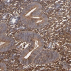 Immunohistochemical staining of human endometrium shows moderate to strong cytoplasmic positivity in glandular and stromal cells.