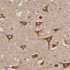 Anti-PGRMC1 Antibody