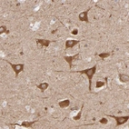 Immunohistochemical staining of human hippocampus shows strong cytoplasmic positivity in neuronal cells.