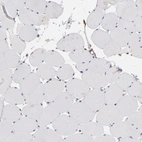 Immunohistochemical staining of human skeletal muscle shows no cytoplasmic positivity in myocytes as expected.