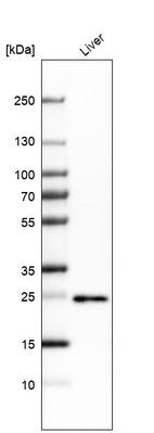 Western blot analysis in human liver tissue.