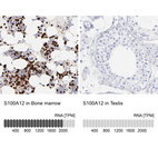 Anti-S100A12 Antibody