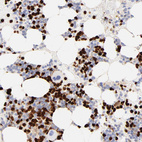 Anti-S100A12 Antibody