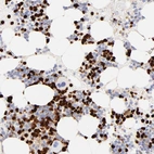 Immunohistochemical staining of human bone marrow shows strong cytoplasmic and nuclear positivity in hematopoietic cells.