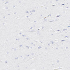 Anti-S100A12 Antibody