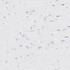 Immunohistochemical staining of human cerebral cortex shows no positivity in neurons as expected.