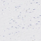 Immunohistochemical staining of human cerebral cortex shows no positivity in neurons as expected.