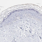 Immunohistochemical staining of human skin shows no positivity in squamous epithelial cells as expected.