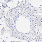 Anti-S100A12 Antibody