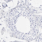 Immunohistochemical staining of human testis shows no positivity in cells in seminiferous ducts as expected.