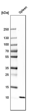 Western blot analysis in human spleen tissue.