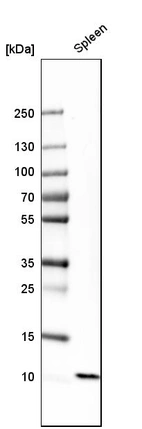Western blot analysis in human spleen tissue.