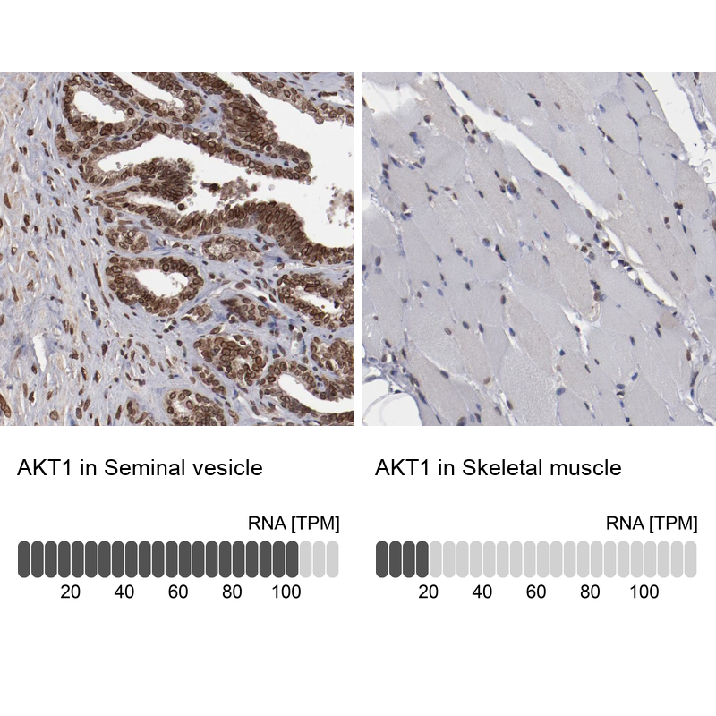 Anti-AKT1 Antibody
