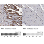 Anti-AKT1 Antibody