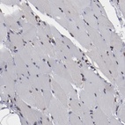 Immunohistochemical staining of human skeletal muscle shows low expression as expected.