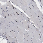 Immunohistochemical staining of human skeletal muscle shows low expression as expected.