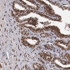 Anti-AKT1 Antibody