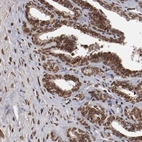 Immunohistochemical staining of human seminal vesicle shows high expression.