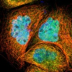 Immunofluorescent staining of human cell line A-431 shows localization to nucleoplasm & microtubules.
