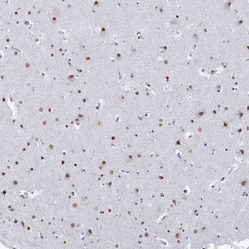 Anti-NPAS3 Antibody