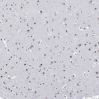 Anti-NPAS3 Antibody