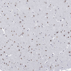 Anti-NPAS3 Antibody