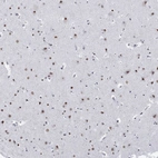 Anti-NPAS3 Antibody