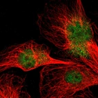 Immunofluorescent staining of human cell line U-251 MG shows localization to nucleoplasm.