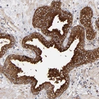 Immunohistochemical staining of human prostate shows high expression.