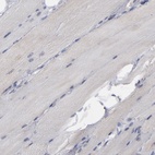 Anti-MIPOL1 Antibody