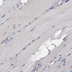 Immunohistochemical staining of human skeletal muscle shows low expression as expected.