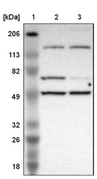 Lane 1: Marker [kDa] 206, 113, 82, 49, 32, 26, 18_br/_Lane 2: Human cell line RT-4_br/_Lane 3: Human cell line U-251MG sp