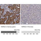 Anti-NDRG2 Antibody